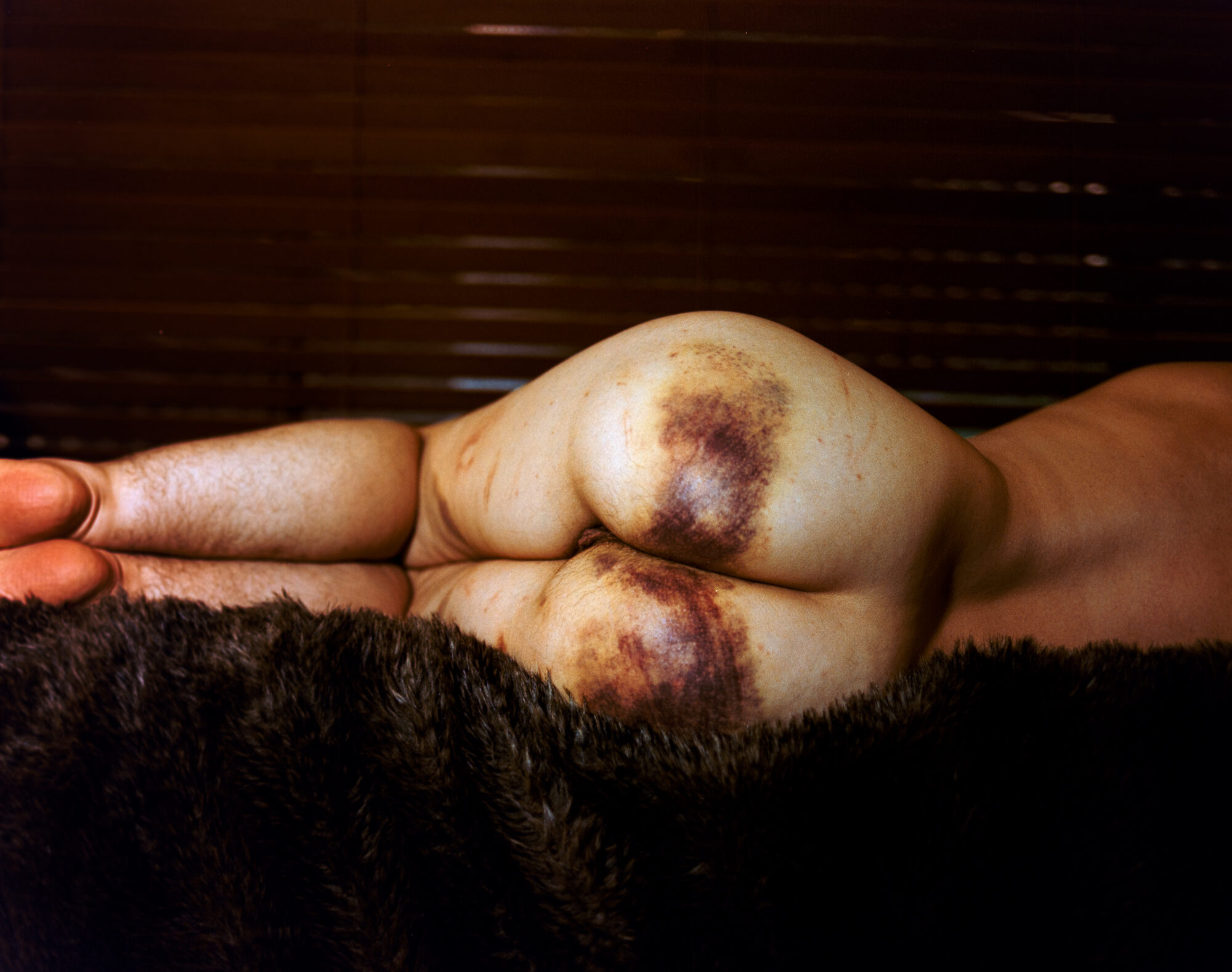 Color intimate body study of a figure lying on dark fur, warm tones with venetian blinds behind. Her backside is deeply bruised from an impact play.